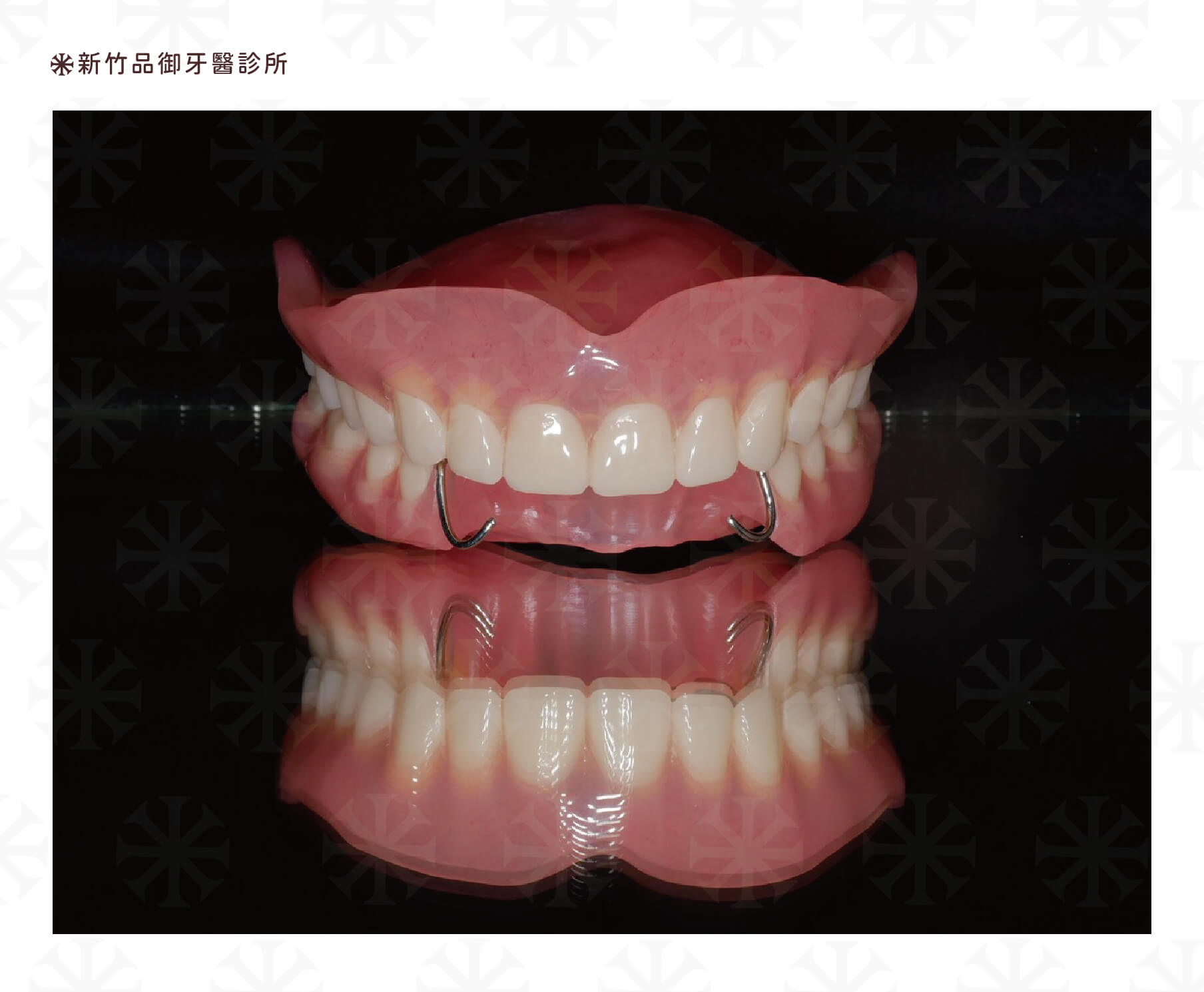 活動假牙