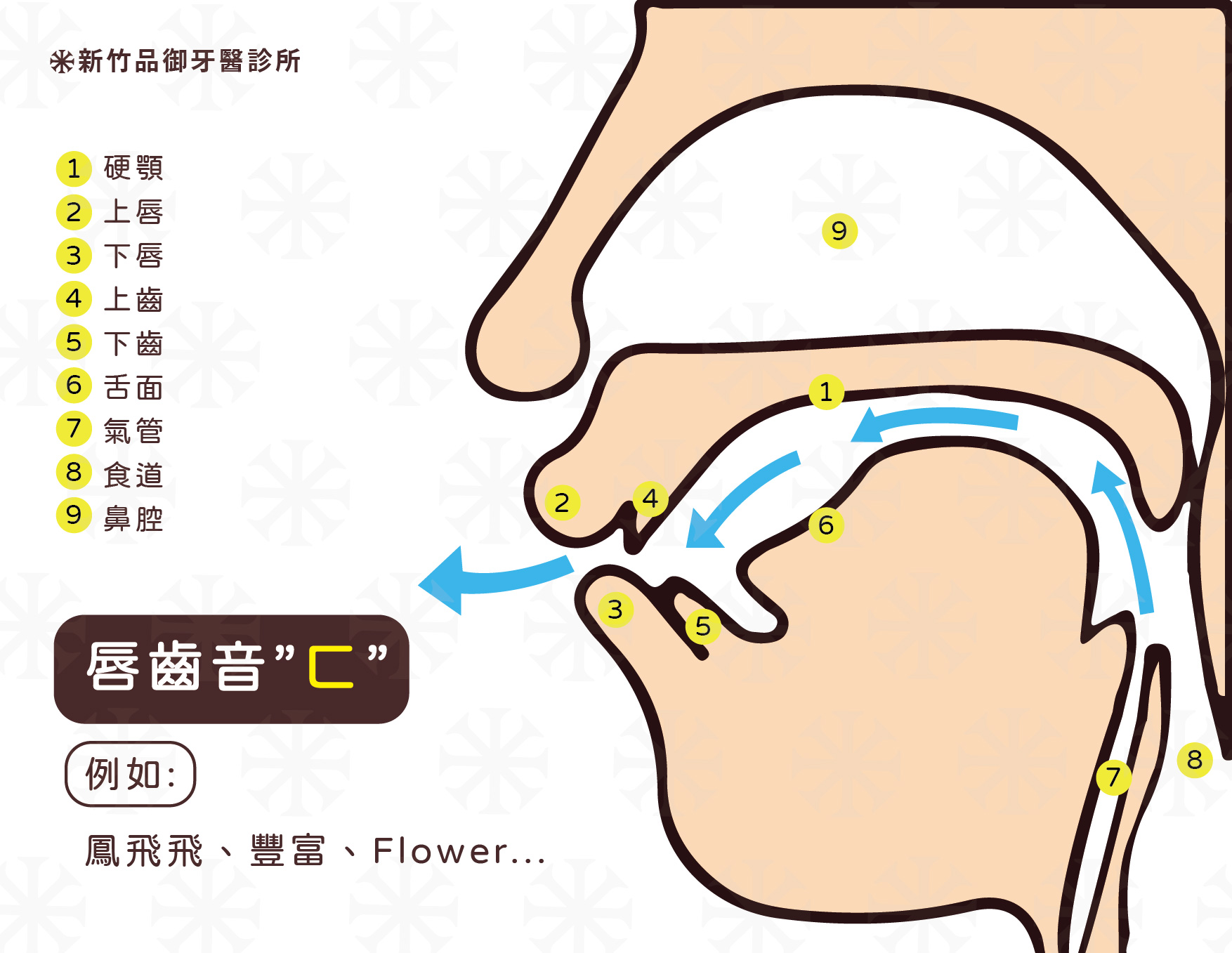 失去門牙會造成「唇齒音」無法順利發出,例如鳳飛飛、豐富⋯⋯等等單詞。