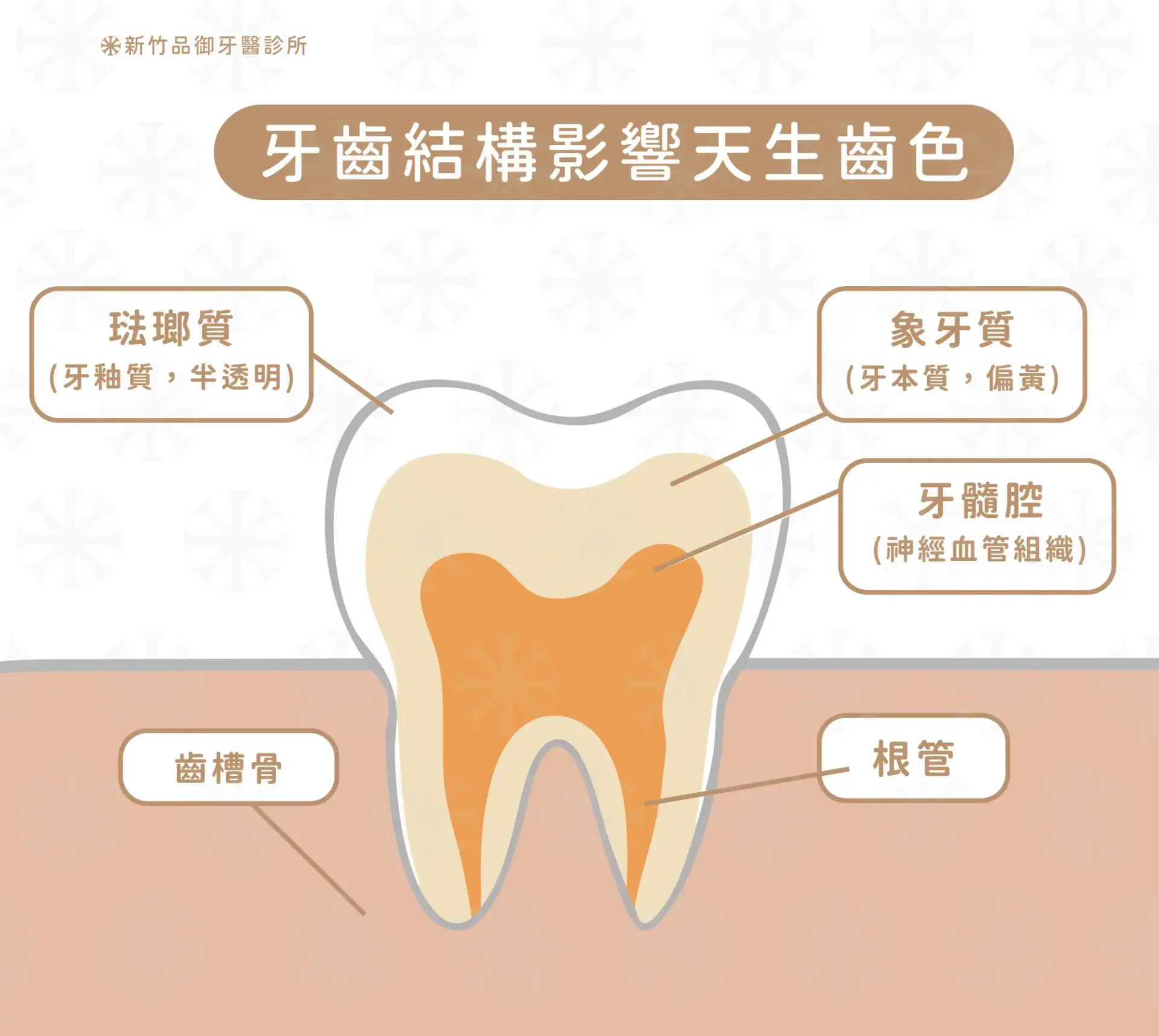 牙齒結構影響天生齒色|象牙質本身偏黃,琺瑯質偏透明。如果天生珐瑯質較厚、較不透明,牙本質的顏色不容易透出來,牙齒看起來就會偏白。反之如果珐瑯質較薄,或珐瑯質透明度較高,天生的齒色就會偏黃。