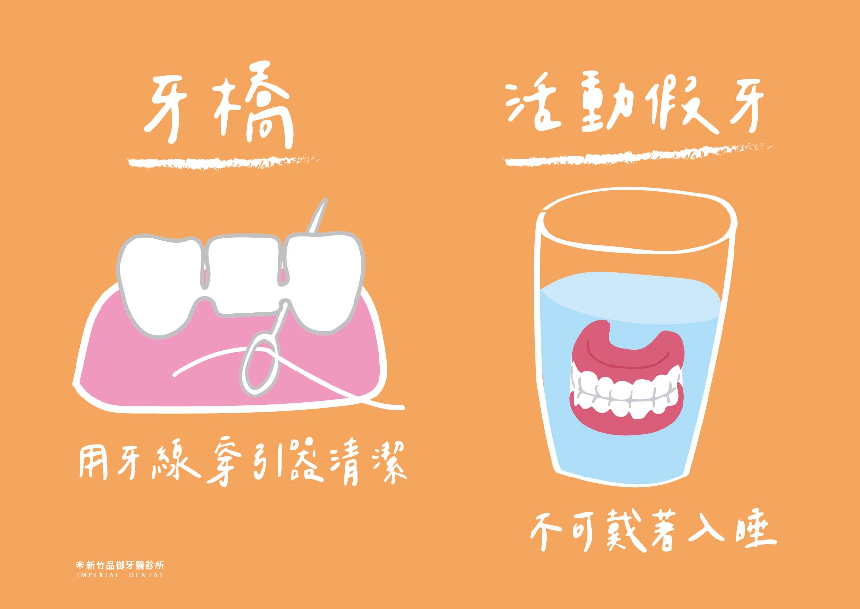 牙橋要用牙線穿引器清潔