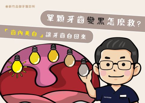 單顆牙齒變黑怎麼救？「齒內美白」讓牙齒重新白回來