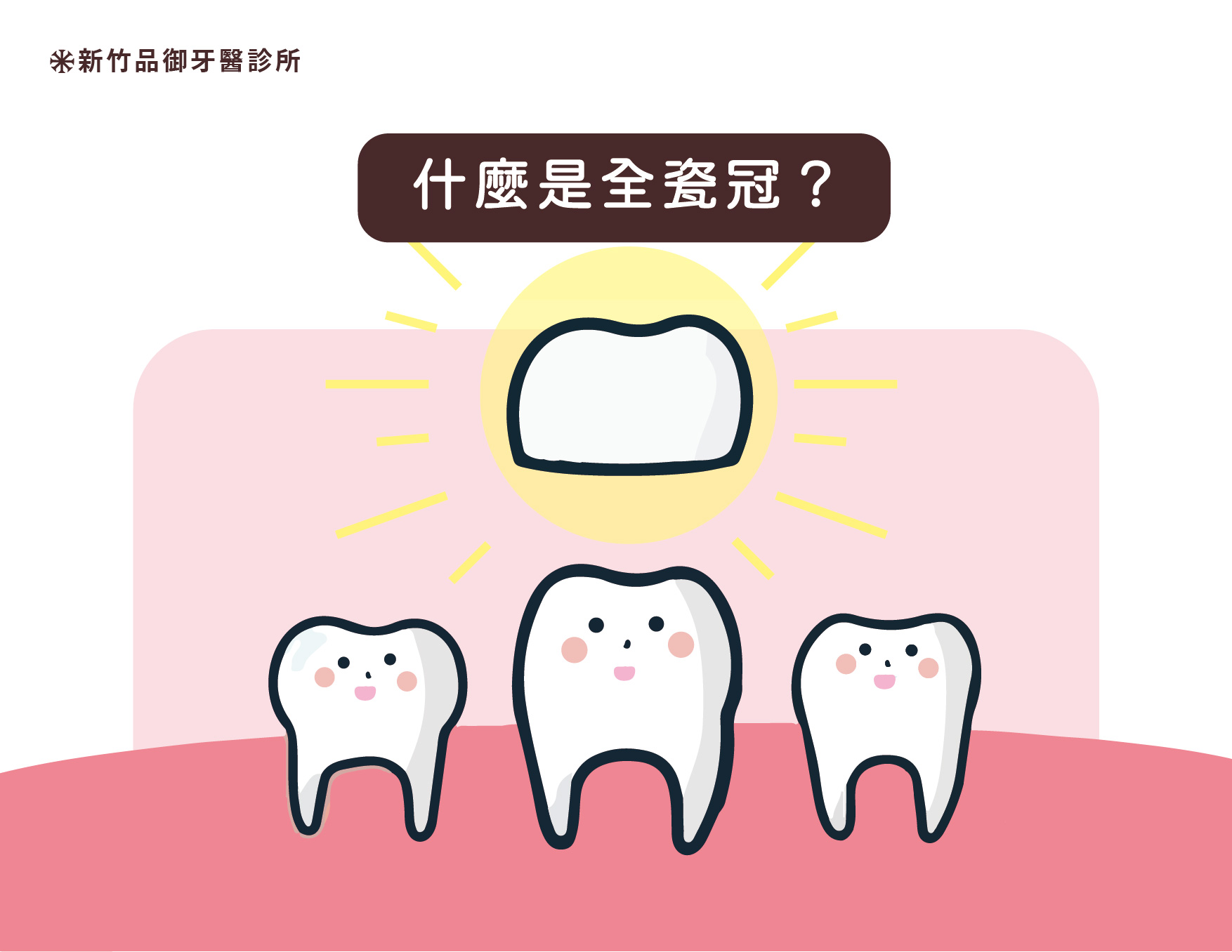 什麼是全瓷冠
