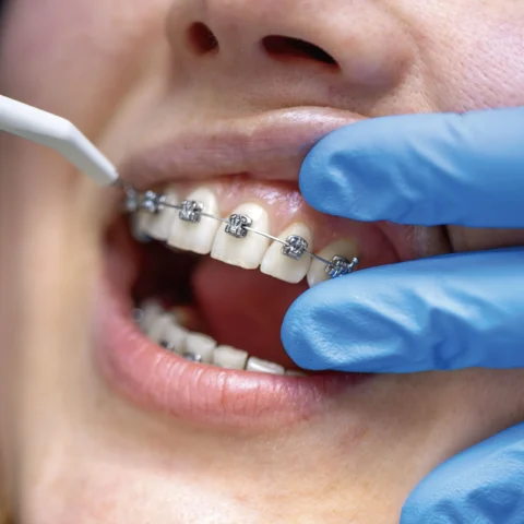 Orthodontics