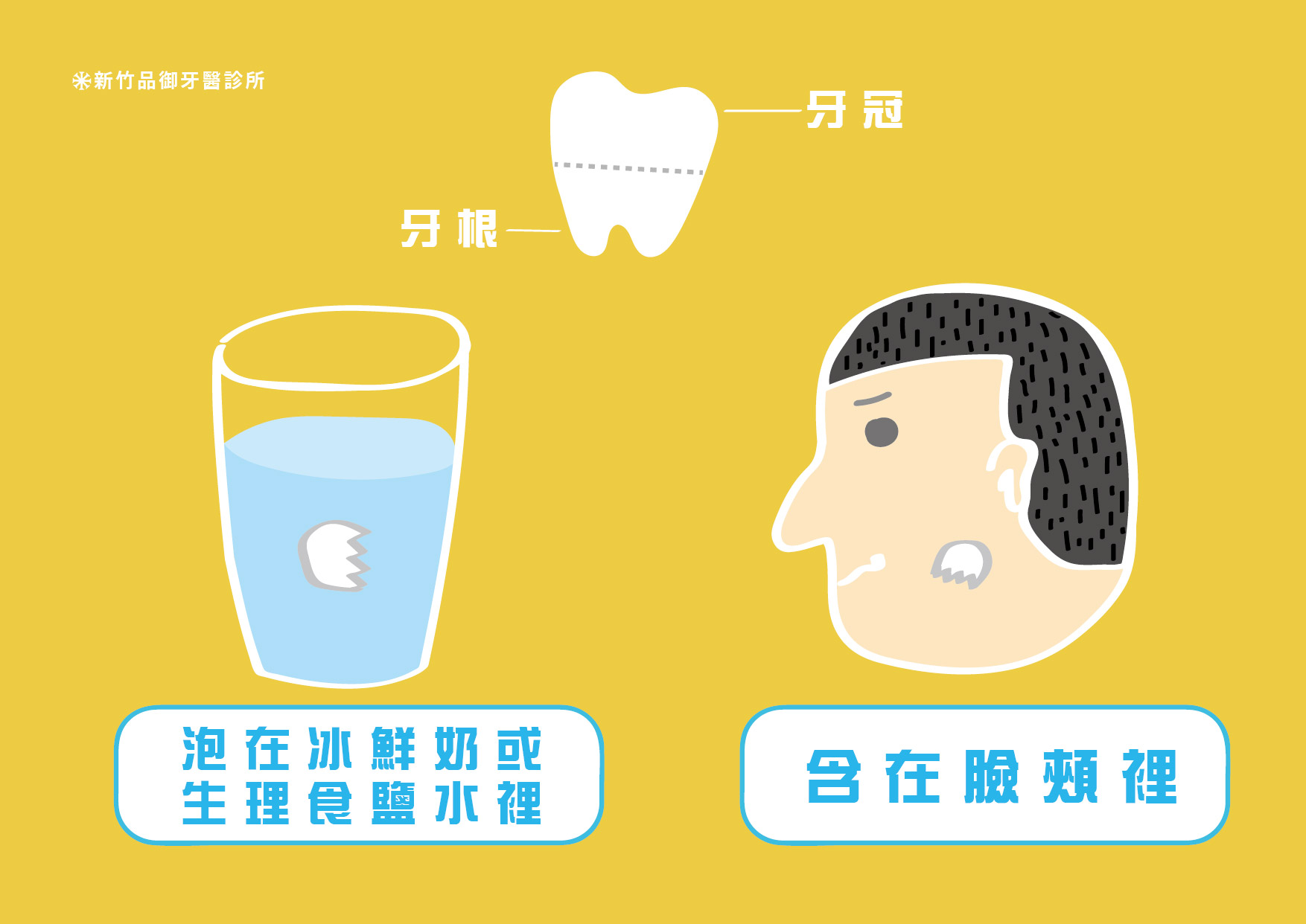 牙齒斷裂的兩種處理方式