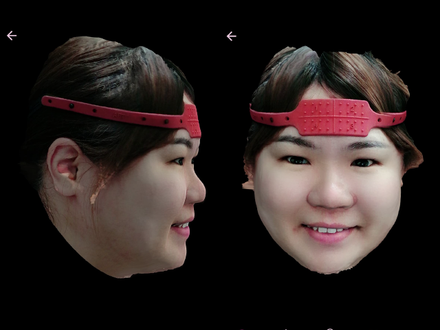 all-on-4 全口重建 3D掃描