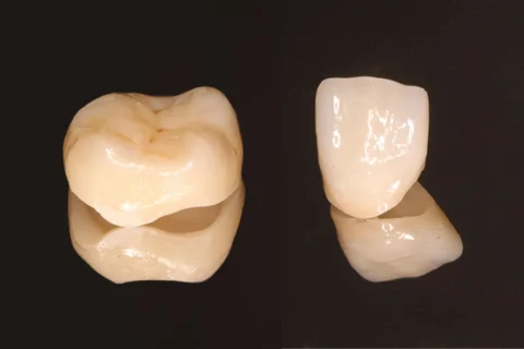 crown