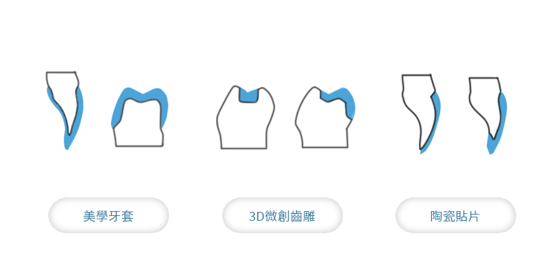 假牙推薦 3D 微創齒雕